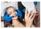 Composite Veneers Brisbane