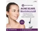 Acne Scars Skin Care Hospital in Bhubaneswar - Best Skin Doctor in Bhubaneswar