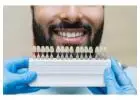 Find minimally invasive Veneers in Tijuana with ultra-thin custom-made shells