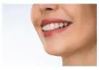 Top Braces Specialist in Paldi – Kids & Adult Braces Available