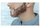 Beard Hair Transplant in Islamabad