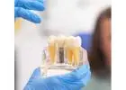 Find top-notch surgeons and dental equipment for Wisdom teeth removal Tijuana